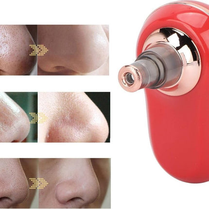 Elektrische Black Head remover - Mee eters - Mee eters verwijderen - Elektrisch - Oplaadbaar - Huidverzorging
